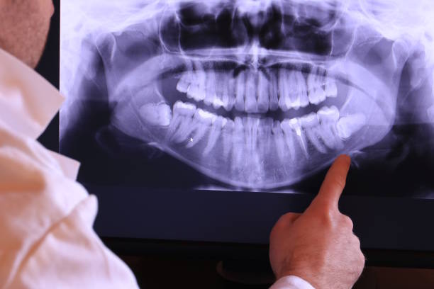 Best Emergency Root Canal Treatment in Midland, NC